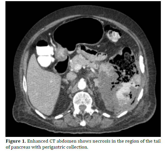 pancreas-necrosis