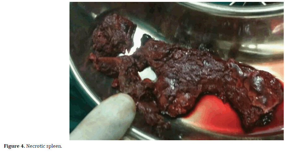 pancreas-necrotic-spleen
