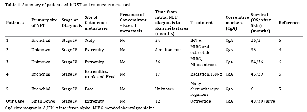 table