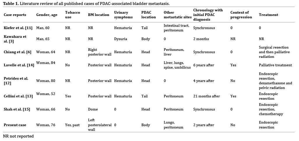 table