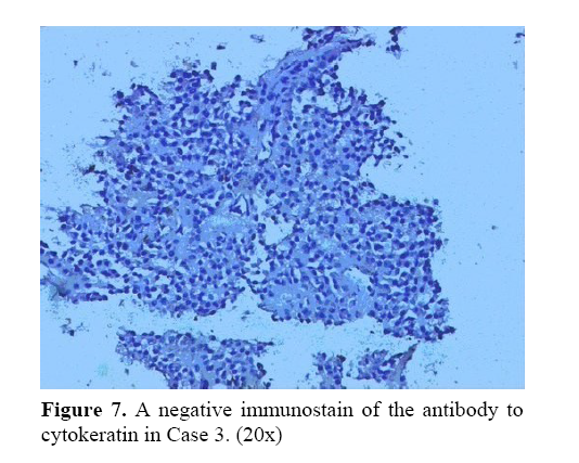 pancreas-negative-immunostain