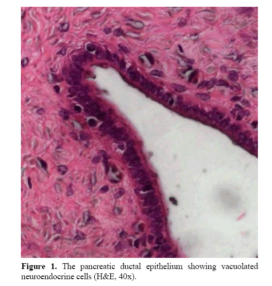 pancreas-neuroendocrine-cells