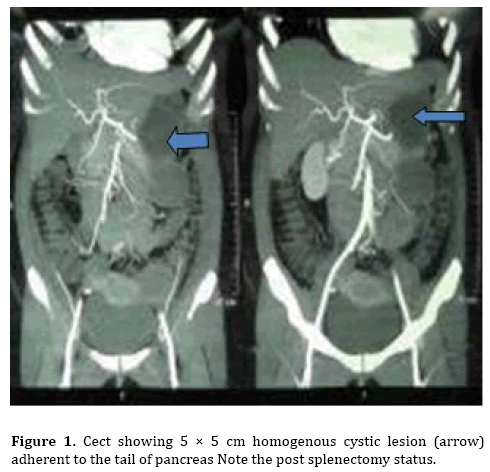 pancreas-homogenous