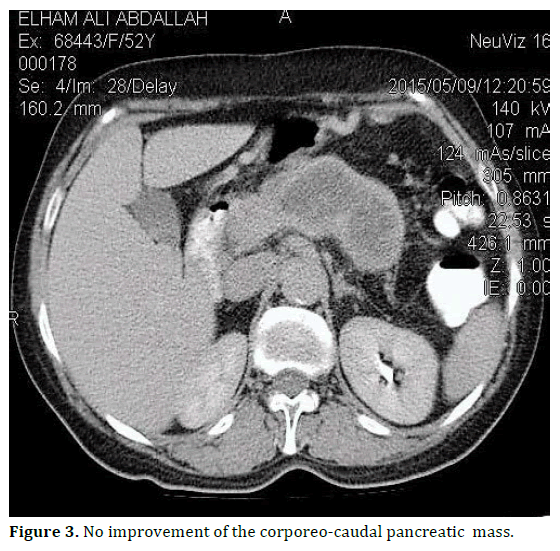 pancreas-no-improvement-corporeo