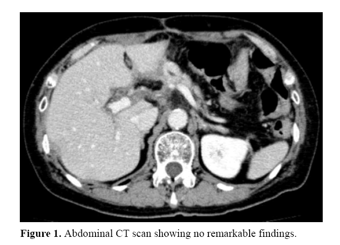 pancreas-no-remarkable-findings