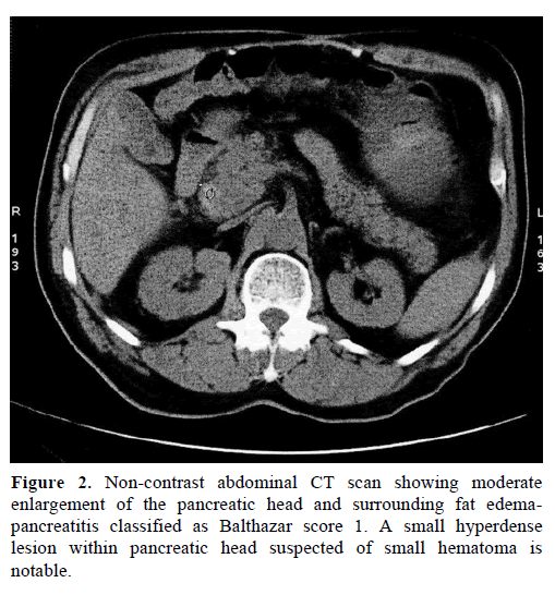 pancreas-non-contrast-abdominal