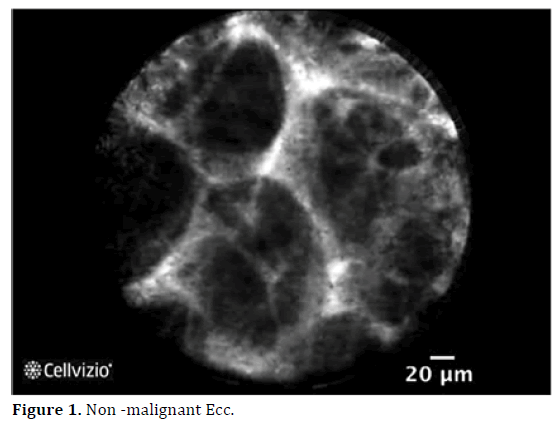 pancreas-non-malignant-ecc