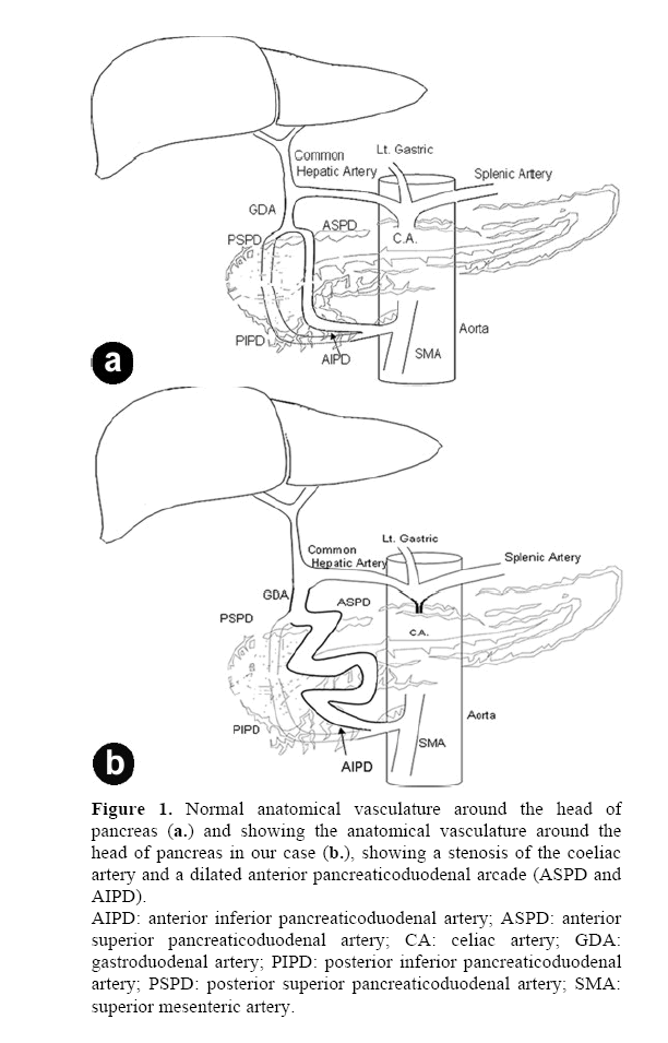 pancreas-normal-anatomical