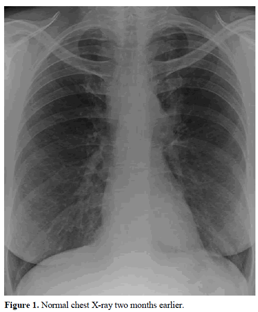 pancreas-normal-chest-x-ray