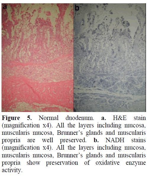 pancreas-normal-duodenum-stain-mucosa