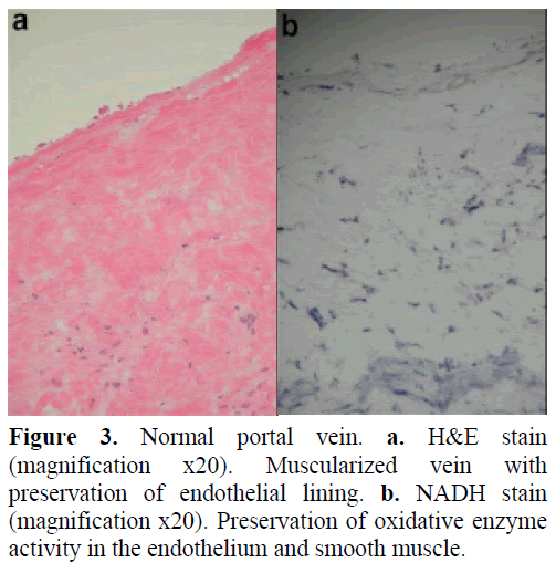 pancreas-normal-portal-vein-stain