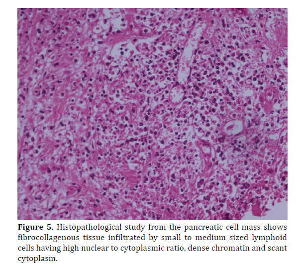 pancreas-nuclear