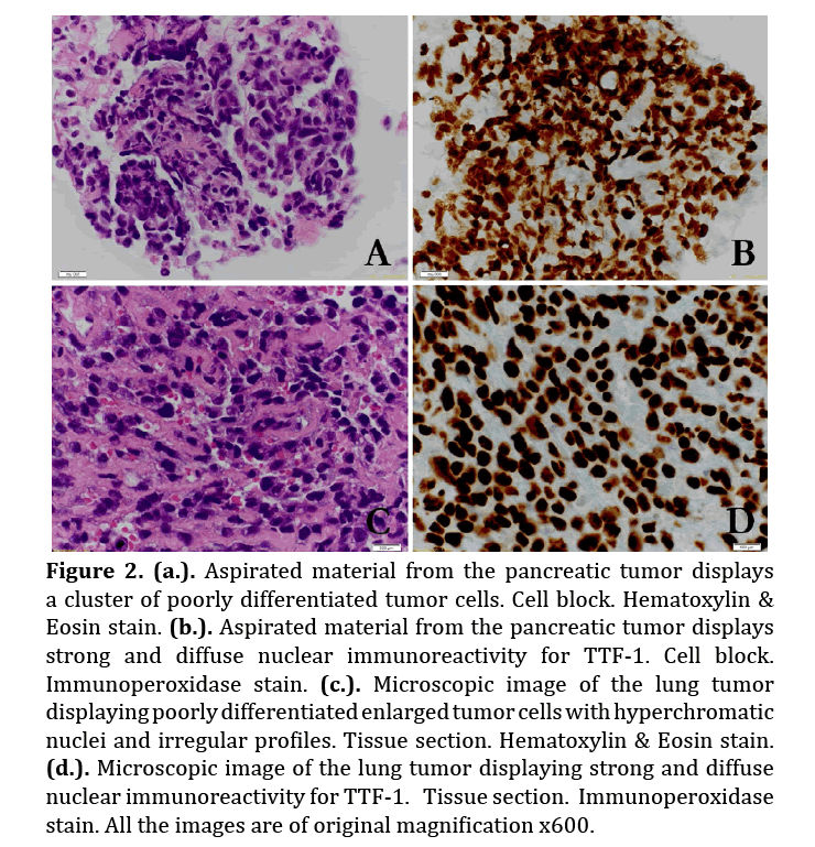 pancreas-nuclear-immunoreactivity