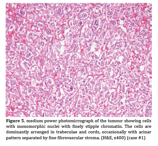 pancreas-occasionally