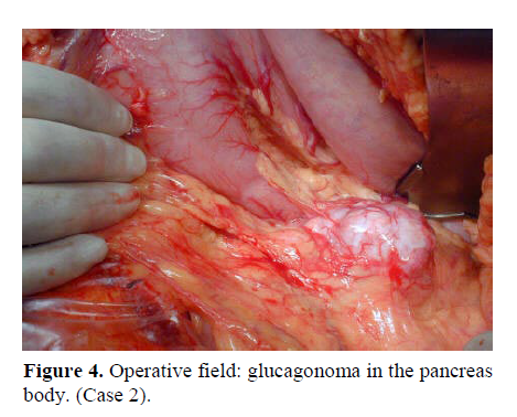 pancreas-operative-field-pathology