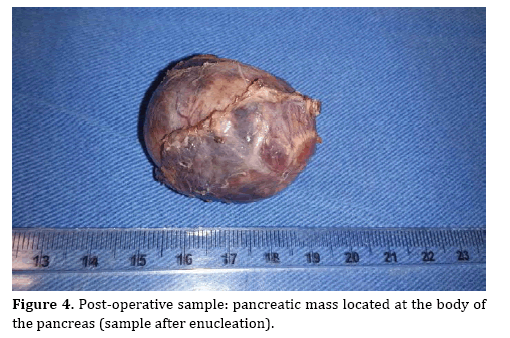 pancreas-operative-sample