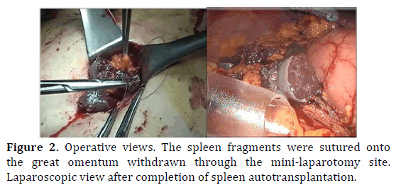 pancreas-operative-views-fragments