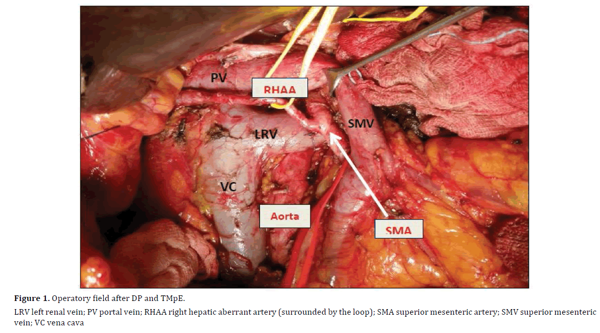 pancreas-operatory-field