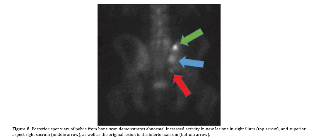 pancreas-original