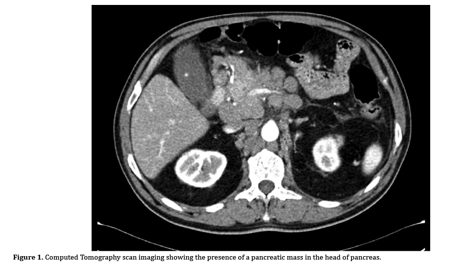 pancreas-pancreatic