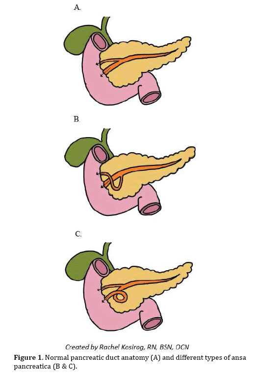 pancreas-pancreatic