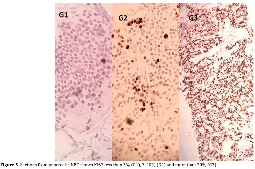 pancreas-pancreatic