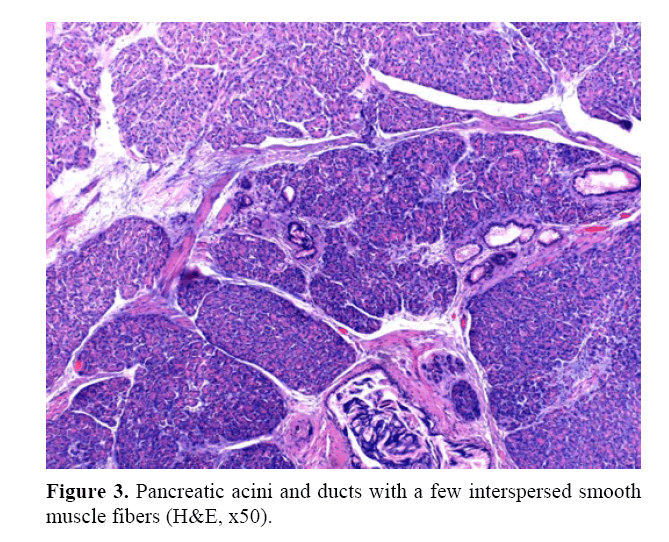 pancreas-pancreatic-acini