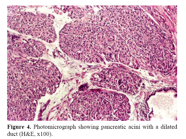 pancreas-pancreatic-acini