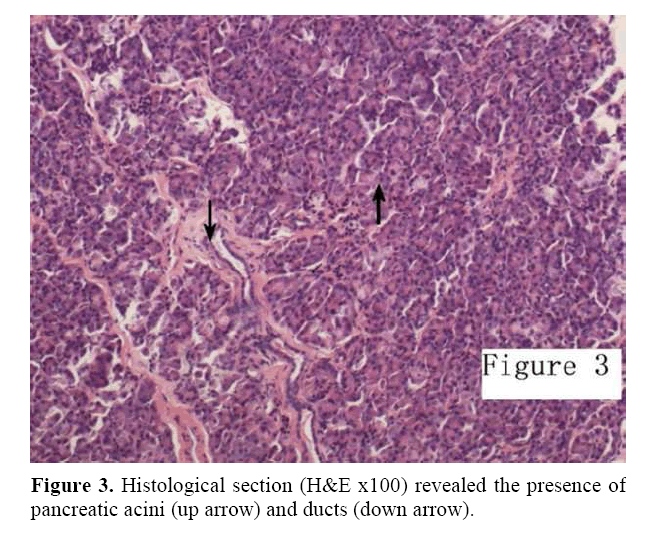 pancreas-pancreatic-acini-up-arrow