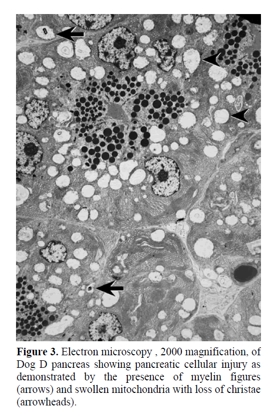 pancreas-pancreatic-cellular-injury