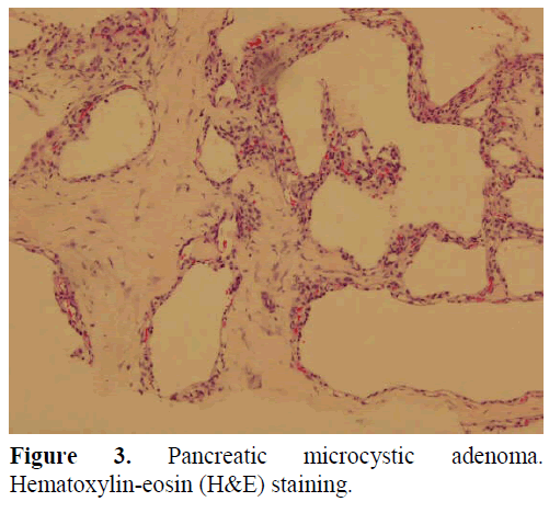 pancreas-pancreatic-hematoxylin-eosin