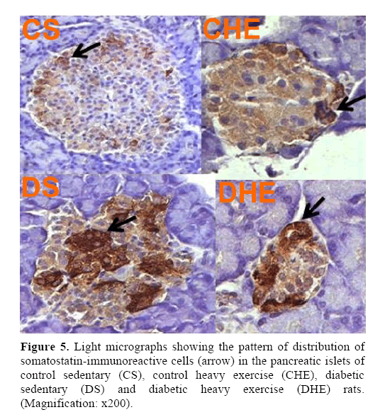 pancreas-pancreatic-islets