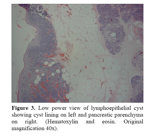 pancreas-pancreatic-parenchyma