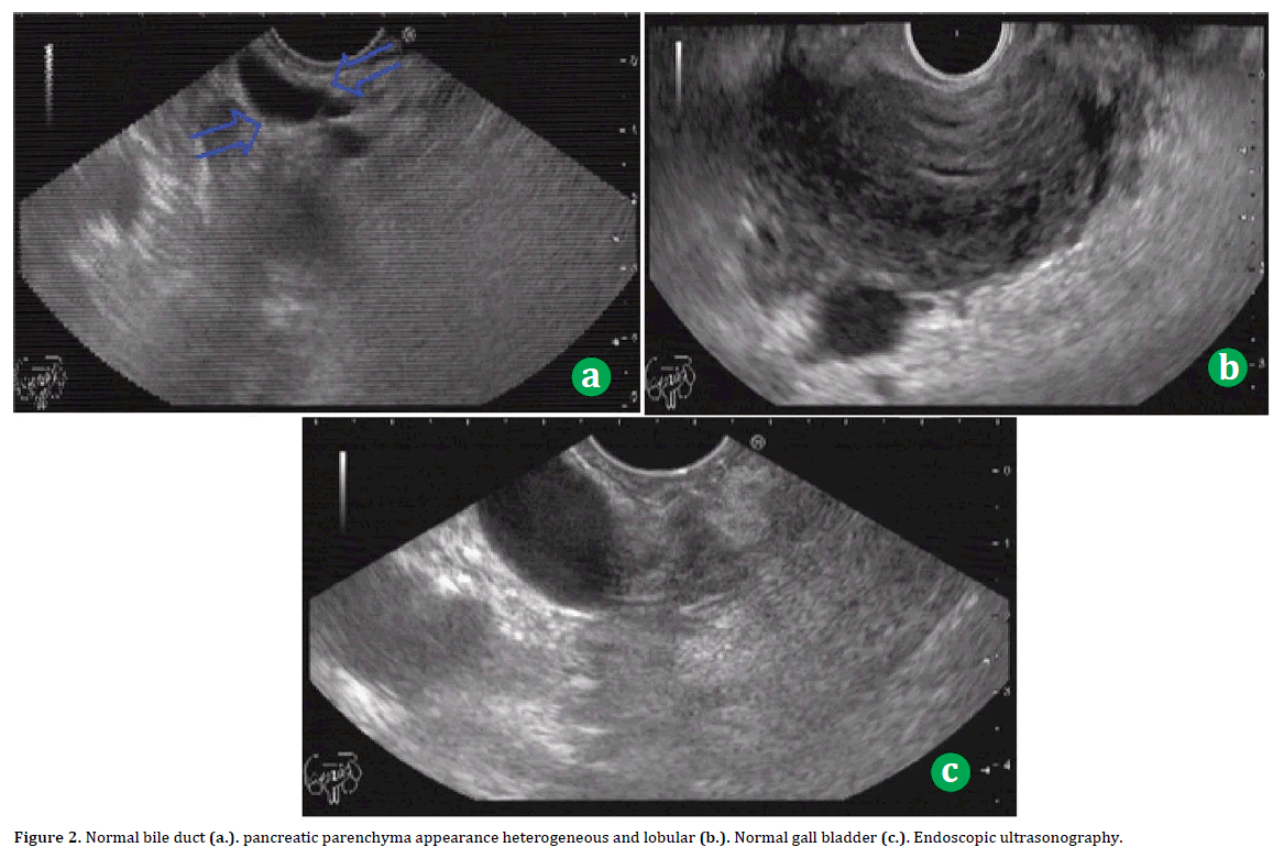 pancreas-pancreatic-parenchyma-heterogeneous