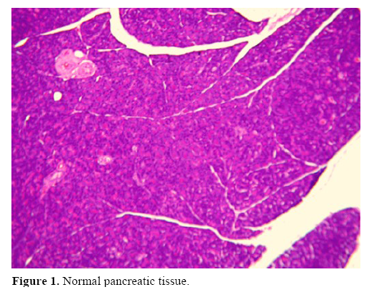 pancreas-pancreatic-tissue
