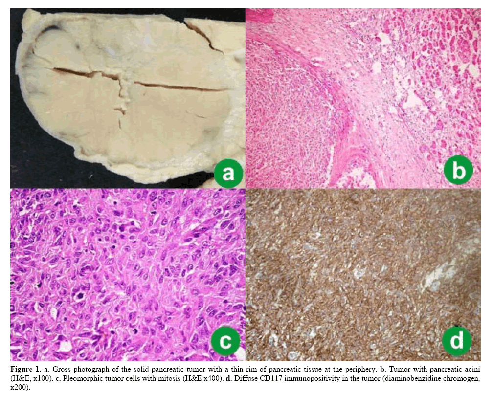 pancreas-pancreatic-tissue-periphery