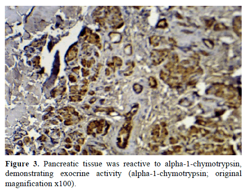 pancreas-pancreatic-tissue-reactive