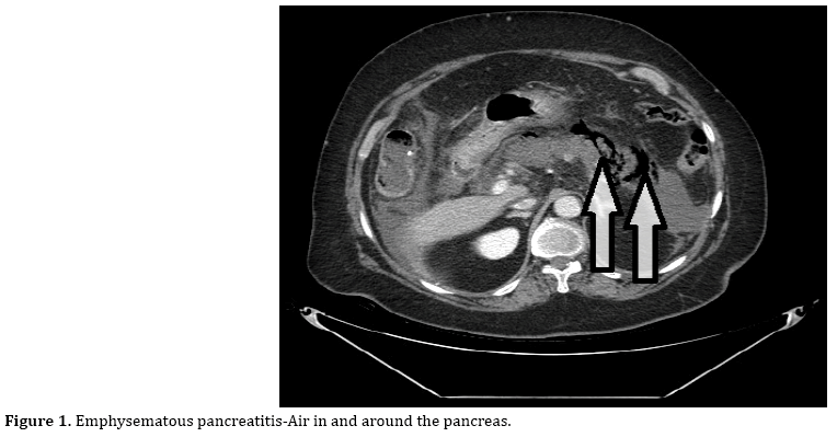 pancreas-pancreatitis