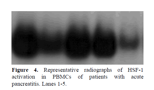 pancreas-pancreatitis-lanes