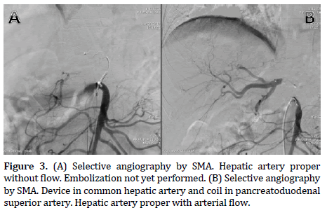 pancreas-pancreatoduodenal