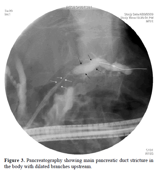 pancreas-pancreatography-main-pancreatic