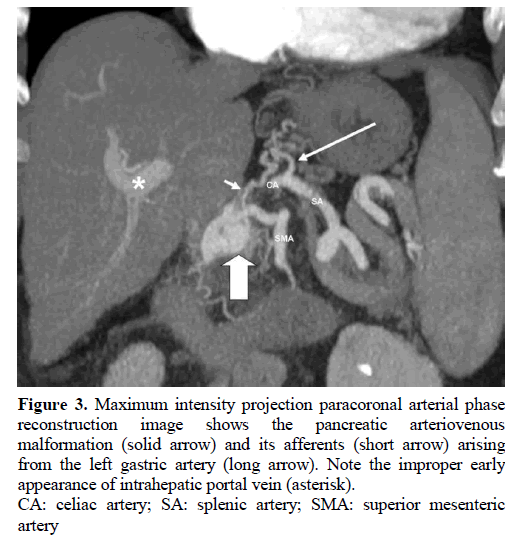 pancreas-paracoronal-arterial-arteriovenous