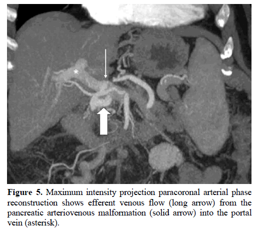 pancreas-paracoronal-arterial-arteriovenous