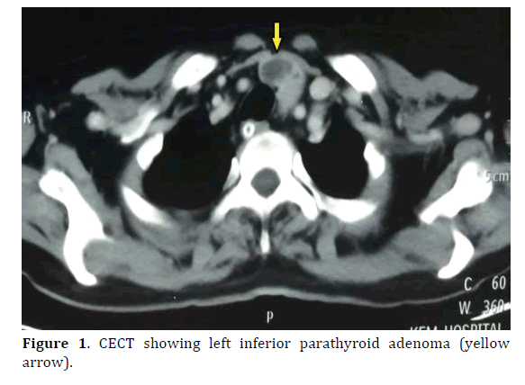 pancreas-parathyroid