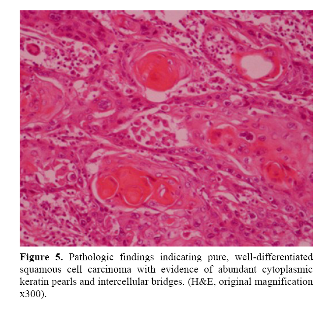 pancreas-pathologic-findings-indicating