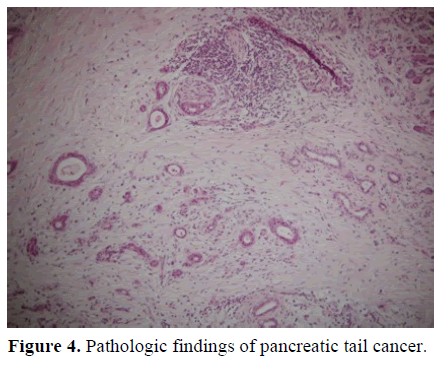 pancreas-pathologic-findings-pancreatic
