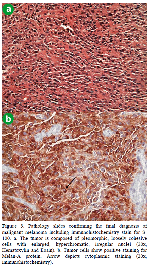 pancreas-pathology-slides-confirming