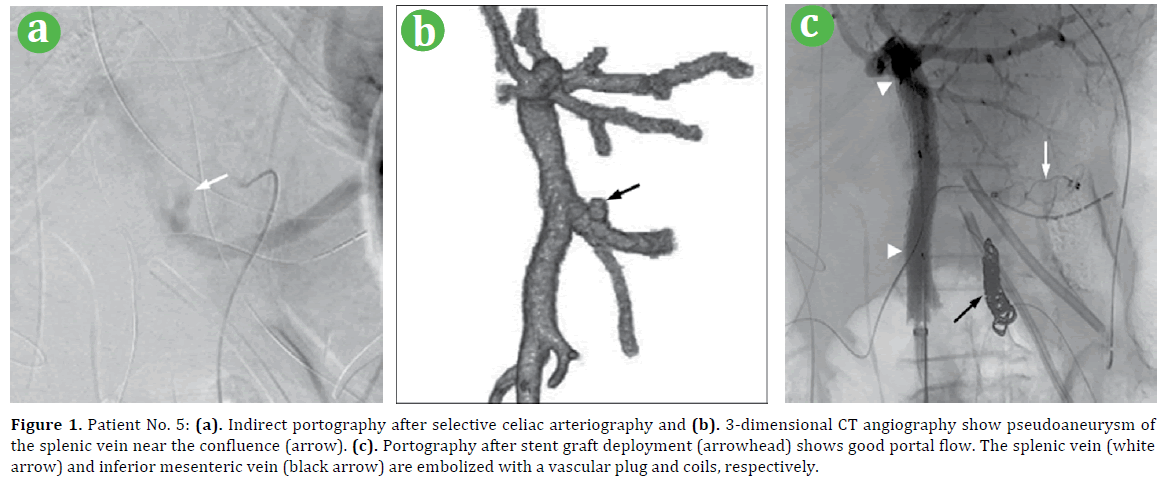 pancreas-patient-indirect-portography