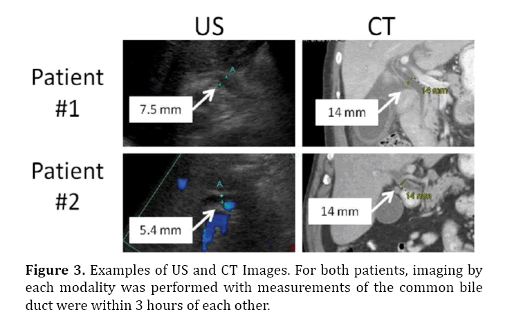 pancreas-performed-with-measurements