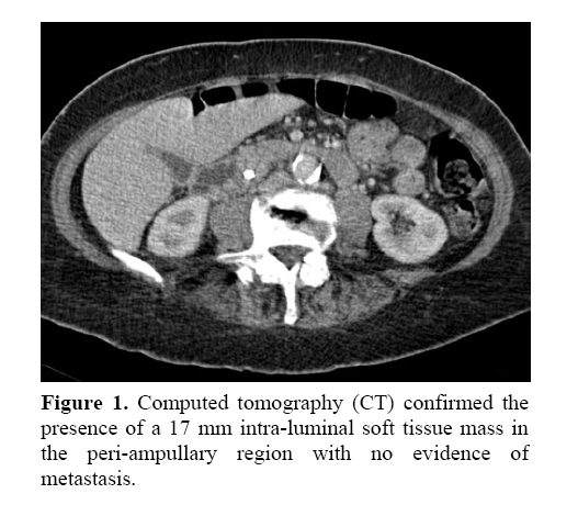 pancreas-peri-ampullary-region